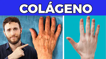 ¿Qué tipo de colágeno es mejor para la elasticidad de la piel?