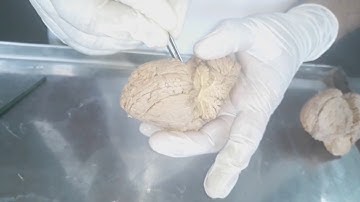 External Features of the Cerebellum