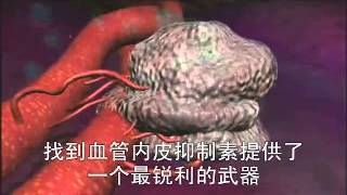 4.Dr.Folkman 腫瘤擴散與轉移之謎