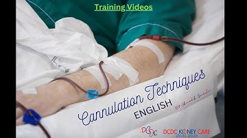 Mastering Cannulation Techniques (English) for Dialysis AV Fistula: Tips and Tricks