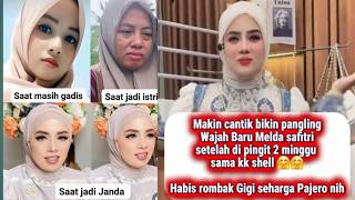 Melda Safitri's New Look After Dental Surgery⁉️ Continuing the Long Dress Promo