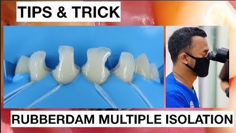 Tips and Trick Isolation With Rubberdam Multiple Anterior Without Clamp | General Dentist Griya RR