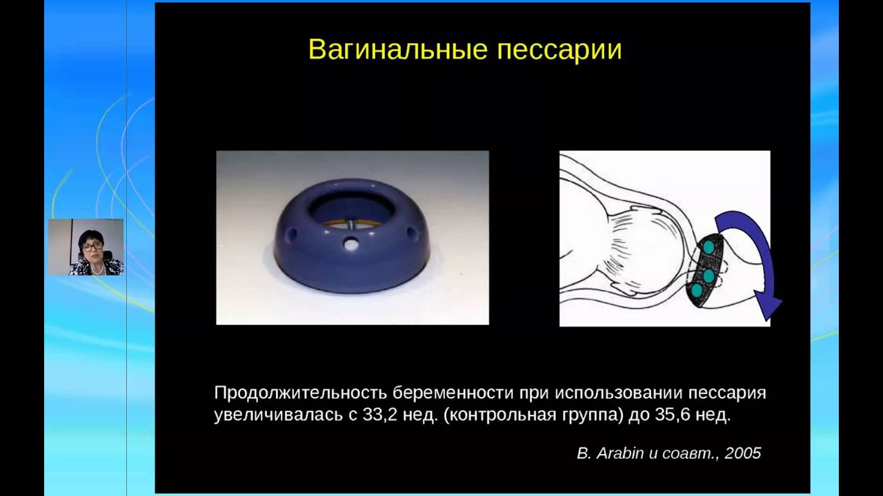 Пессарий это при беременности