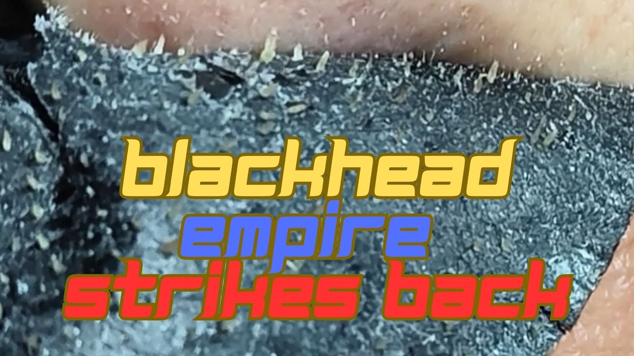 Satisfying Blackhead Removal using Pore Pack/Strips 12 YouTube