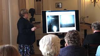 Chronic Obstructive Pulmonary Disease - A Global Issue - Profesor Wisia Wedzicha