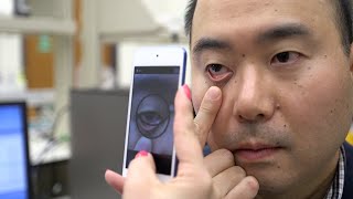 Spectroscopic analysis with a smartphone app to help assess anemia screenshot 1