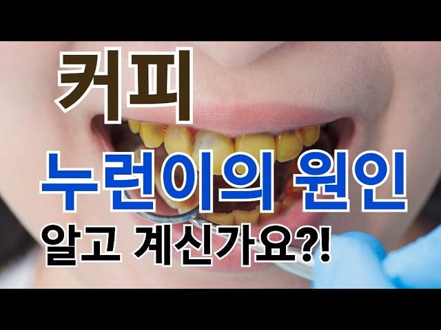식후 커피가 치아변색의 원인!