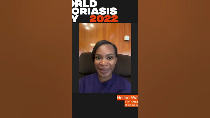 How Sharing Your Experiences with #Psoriasis can Inspire Others. #shorts #skincare #stigma