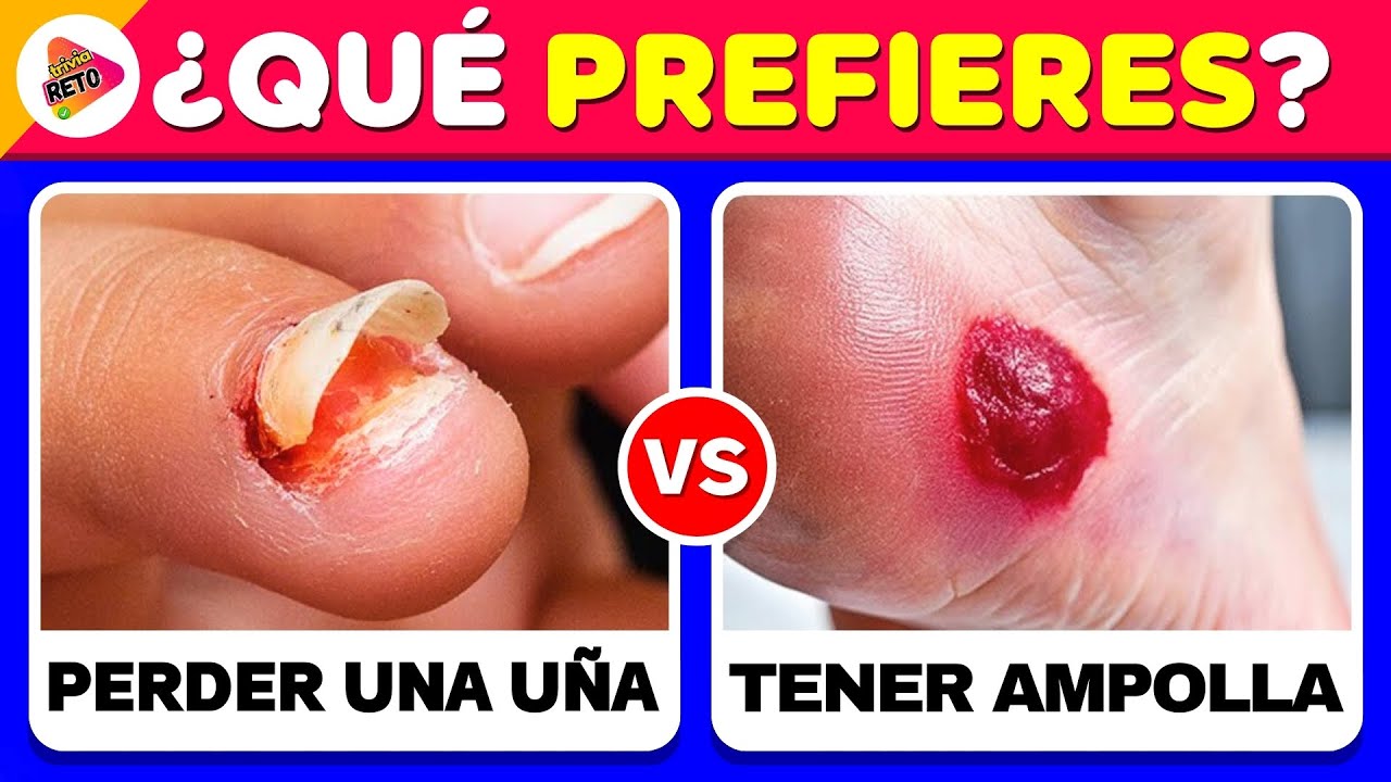 ¿Qué PREFIERES?😨¡Las Decisiones MÁS difíciles de Tu Vida! ⚠️🧠