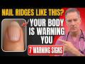 Neurologist Warns About Vertical Ridges on Nails After 60, What Are Your NAILS Trying to Say?