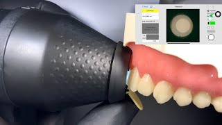 OptiShade/CompoShade - Digital system for tooth color detection