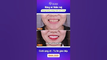 Răng trắng sáng, hết xỉn màu, cười tự tin sau bọc sứ thẩm mỹ #bocsuthammy #rangxinmau #shorts