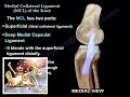 Medial Collateral Ligament Of The Knee - Everything You Need To Know - Dr. Nabil Ebraheim