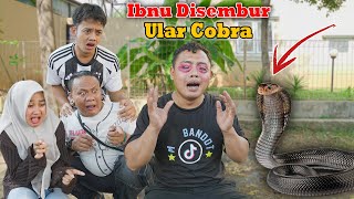 Ibnu's eyes were sprayed by a cobra snake, leaving him red and almost blind.