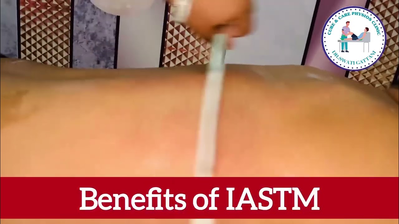 IASTM Therapy | Instrument-Assisted Soft Tissue Mobilization