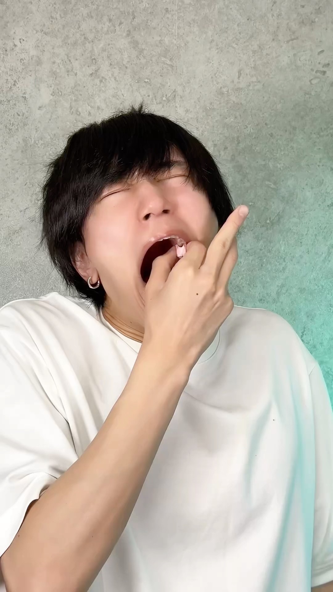 When Your Tooth Falls Out…?