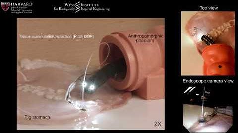 Soft Robotics for Endoscopy