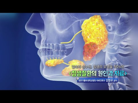 TV메디컬 약손_침샘질환의 원인과 치료