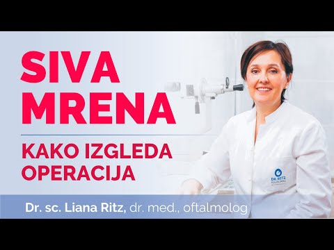 Siva mrena (katarakta): kako izgleda operacija I Poliklinika Ritz