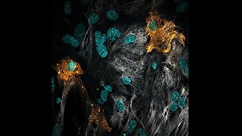 Microinjected live brain cells