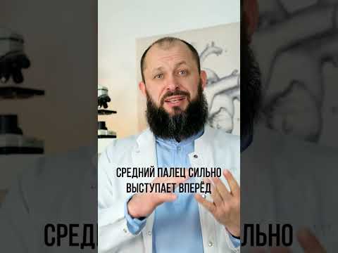 Как определить болезни по рукам? #shorts