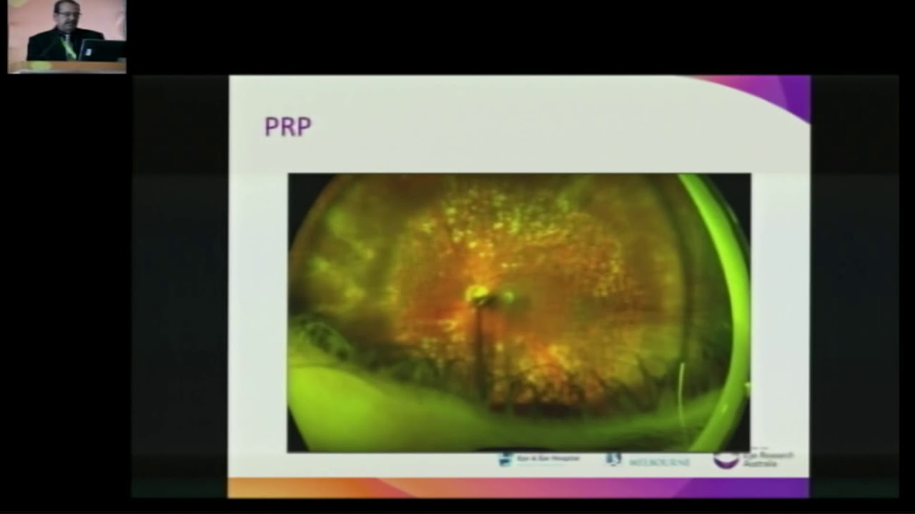 AIOC2018 - IC183 - Managing Neovascular Glaucoma. Keynote Address by Dr. NITIN VERMA