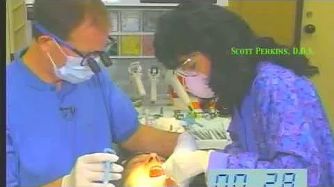 15 Minute Crown  Procedure (Part 1)