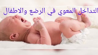 التداخل المعوي أو الانسداد المعوي في الرضع والاطفال ( intussusception)