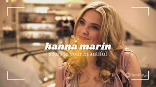 scars to your beautiful - hanna marin