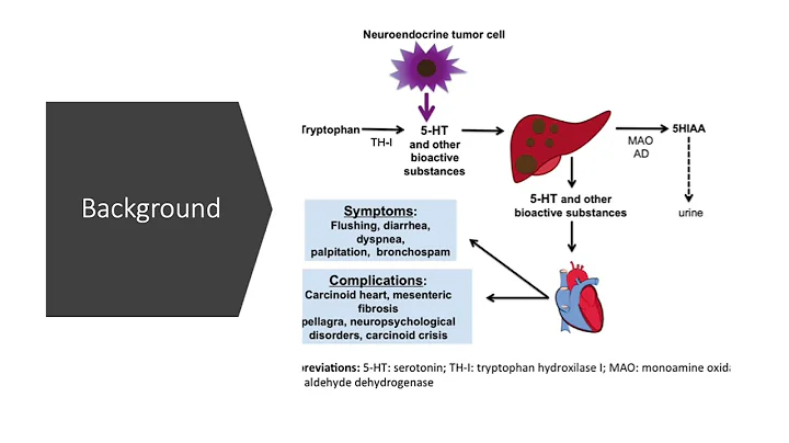 Perioperative Management of Patients with Neuroendocrine Tumors by Clarissa Hanna, MD Candidate 2022