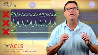 ACLS Adult Cardiac Arrest Algorithm - PEA/Asystole screenshot 2