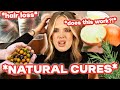 HOW TO REGROW YOUR HAIR after TELOGEN EFFLUVIUM - 5 strangest cures for hair loss