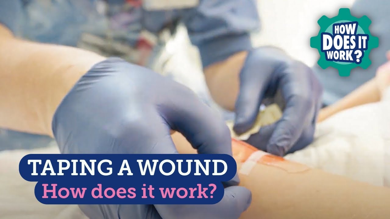 Taping Rip Off Skin Taping a Wound - YouTube