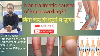 Non traumatic causes of knee swelling चोट के बिना घुटने की सूजन ?Treatment? #kneeswelling #swelling