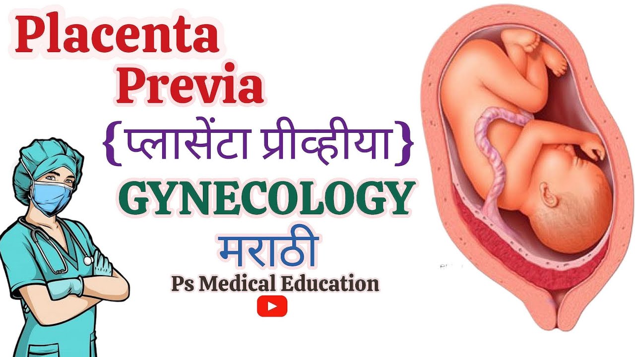PLACENTA PREVIA || GYNECOLOGY || GNM 3RD YEAR || GNM NURSING CLASSES IN MARATHI