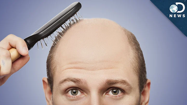 Why Do Men Go Bald?