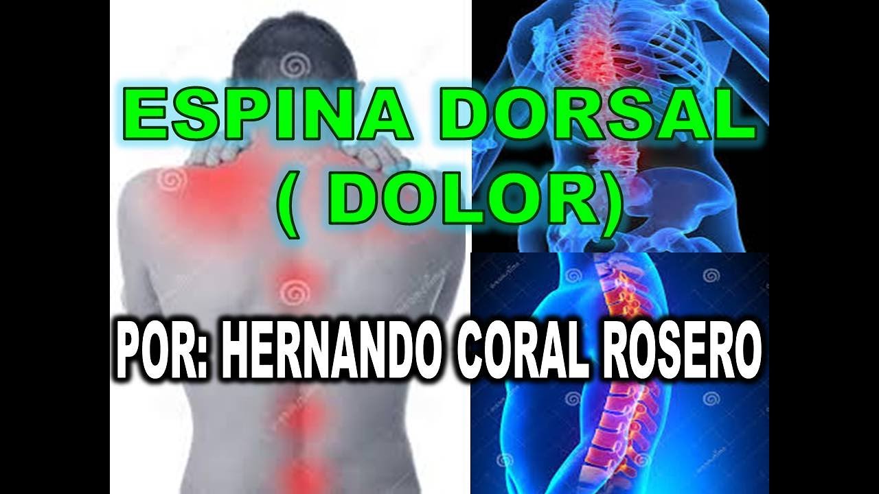 [DIAGRAM] Diagrama De Espina Dorsal - MYDIAGRAM.ONLINE