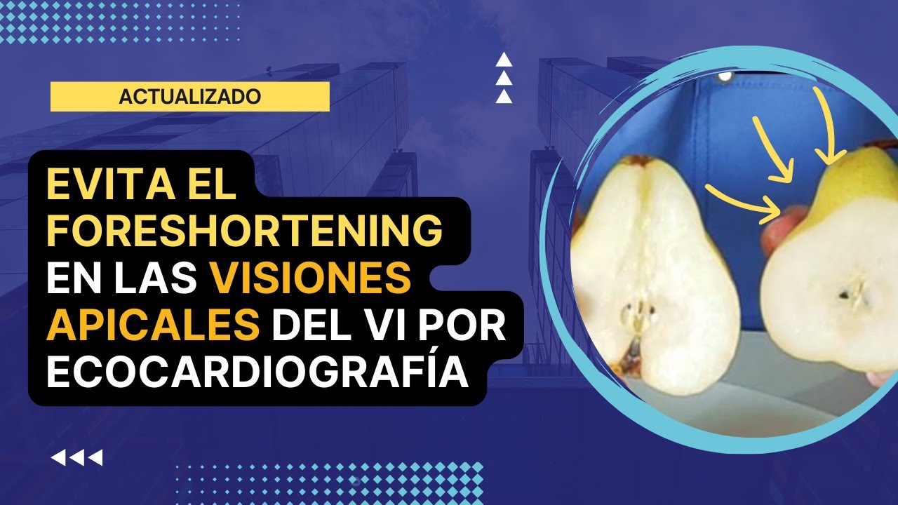 ⛔️[EVITA] el FORESHORTENING en VISIONES APICALES del VENTRICULO IZQUIERDO por ECOCARDIOGRAFIA⚠️