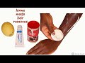 How to make Hair Removal at Home🙀 With 3 Ingredienser