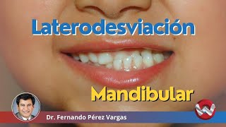 Tratamiento de laterodesviación mandibular