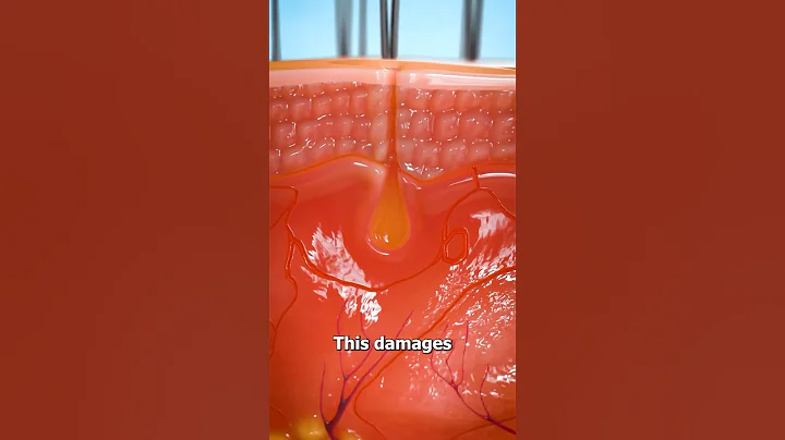 Why You Shouldn’t Pluck Hairs 😨 Surgeon Reacts