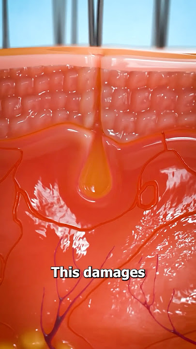 Why You Shouldn’t Pluck Hairs 😨 Surgeon Reacts