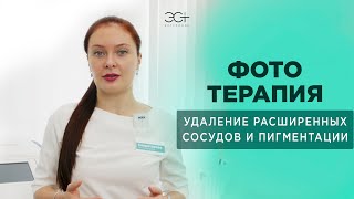 ФОТОТЕРАПИЯ. Удаление расширенных сосудов и пигментации