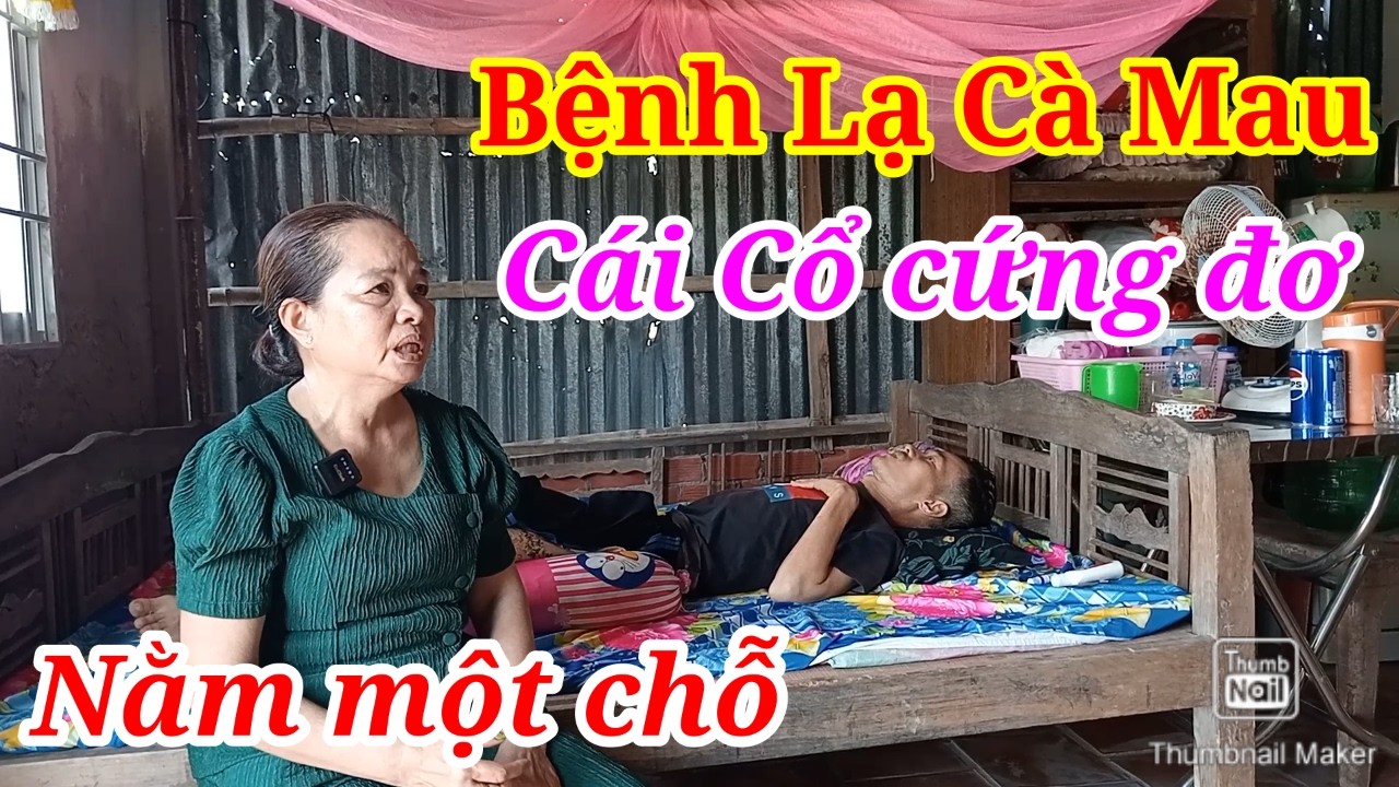 Bệnh Lạ Cà Mau Cái Cổ Cứng Đơ Nằm Luôn Một Chỗ