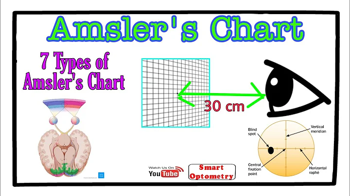 Amsler's Chart - An Overview (7 Charts)