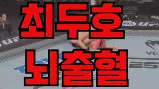 최두호 뇌출혈에 걸려 생명이 위급한 상황