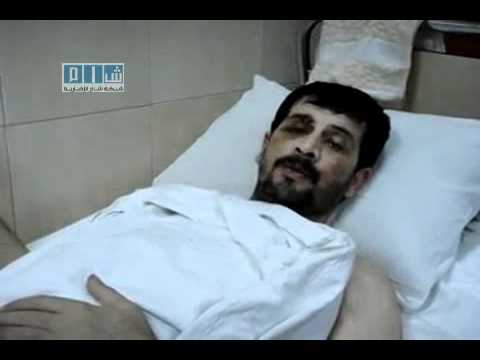شام - دوما - أحد أبطال دوما المصابين يتحدث 6-4-2011