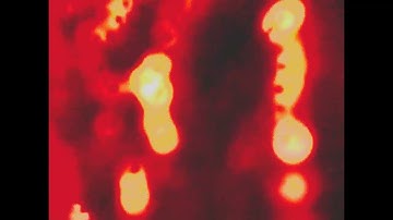 Anchoring and isolation