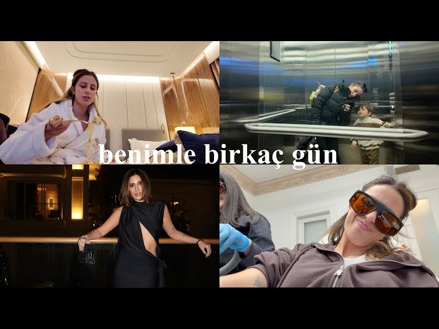 DÖVMELERİMİ SİLDİRİYORUM ! | ödül törenine hazırlık