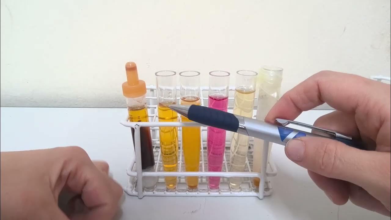 Der Unterschied zwischen Serum und Plasma, Farben und ihre Bedeutung YouTube